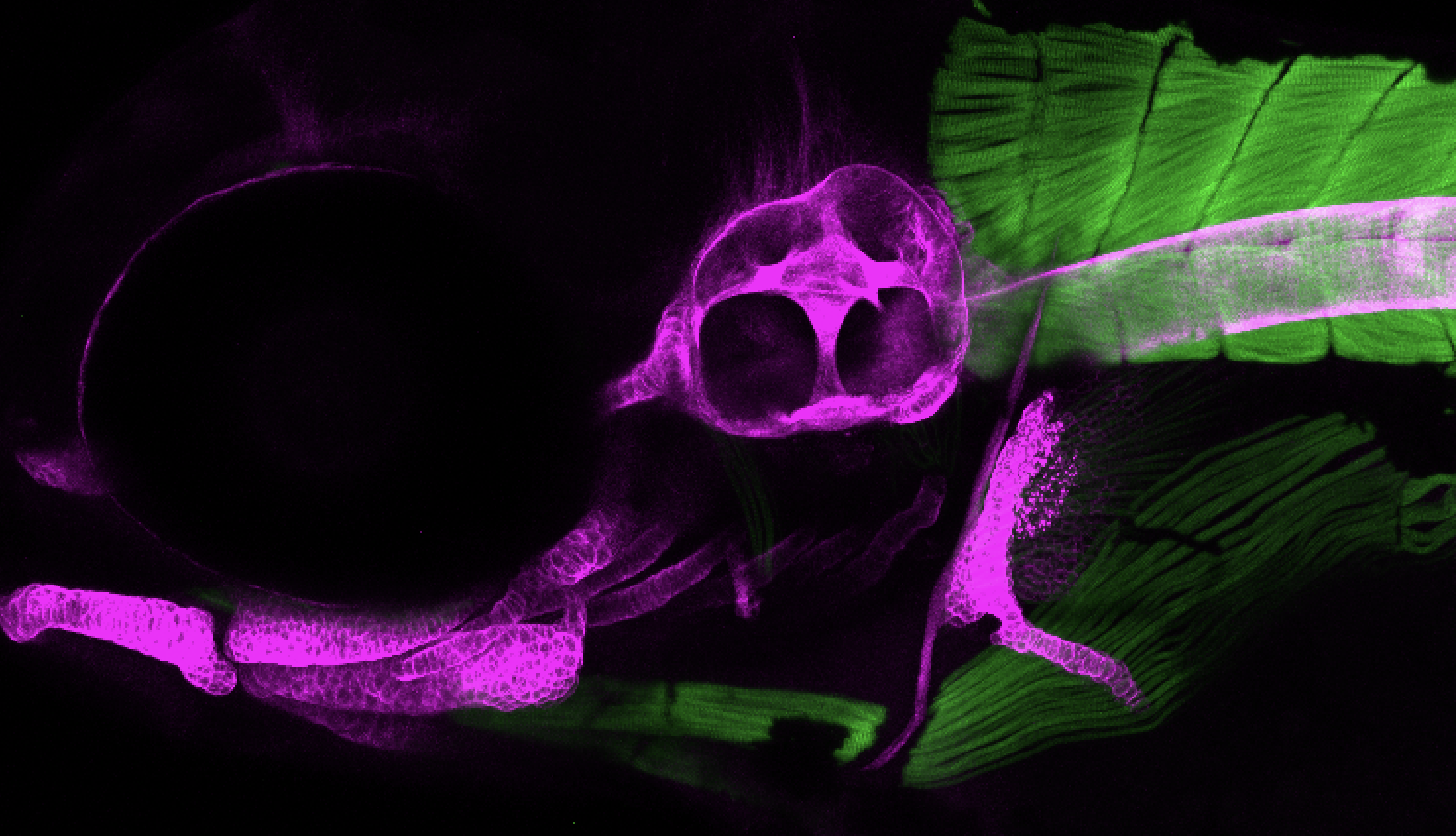 jaw muscle
