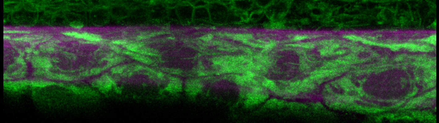 sheath-er-collagen